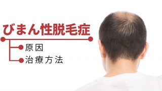 頭全体が薄毛になるのはびまん性脱毛症。女性だけでなく男性も発症するぞ